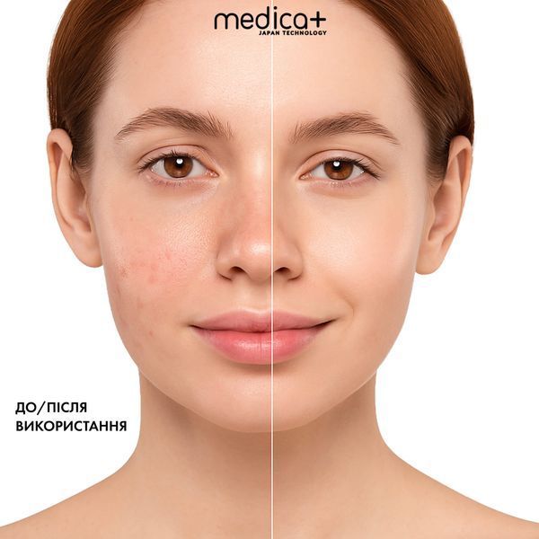 LED-маска для світлотерапії Medica+ LEDMask 8X MD-60082 фото
