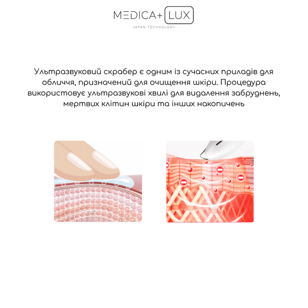 Ультразвуковий скрабер Medica+ Lux SuperSonic 10 MD-50992 фото
