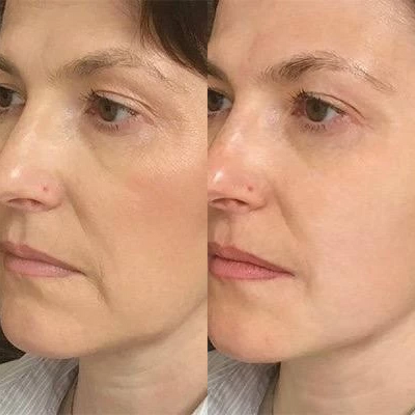 Порозвужувальна маска для обличчя Medica+ Pore Control Mask, 50 мл MD-60051 фото