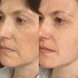Порозвужувальна маска для обличчя Medica+ Pore Control Mask, 50 мл MD-60051 фото 12