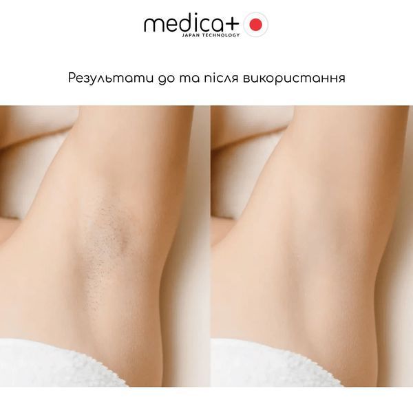 Фотоепілятор Medica+ Haircleaner 8.0 MD-50141 фото