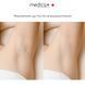 Фотоепілятор Medica+ Haircleaner 8.0 MD-50141 фото 12
