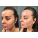 Мікрострумовий ліфтинг Medica+ Skin Lifting 6.0 White MD-50237 фото 10