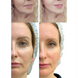 Мікрострумовий RF Lifting Масажер для обличчя Skin Lifting 7.0 White - EMS, LED MD-50179 фото 12