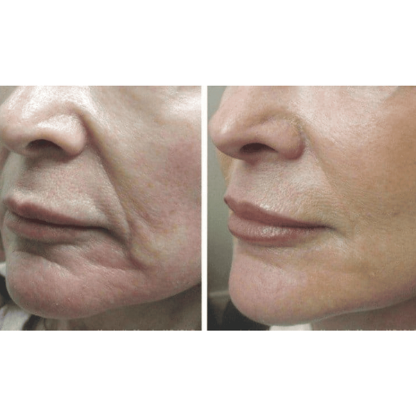 Мікрострумовий ліфтинг-масажер Medica+ Skin Lifting 5.0 MD-50229 фото