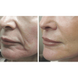 Мікрострумовий ліфтинг-масажер Medica+ Skin Lifting 5.0 MD-50229 фото 4