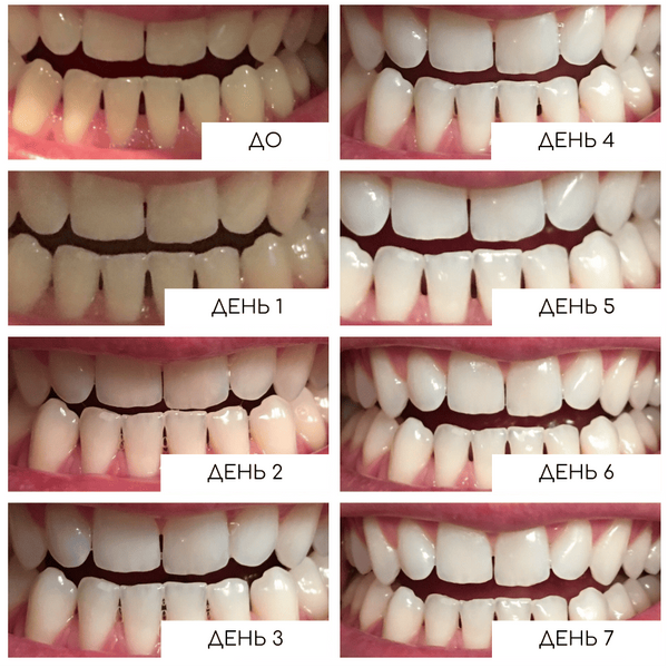 Відбілювальні смужки Medica+ 3DWhite Strips MD-51002 фото