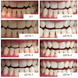 Відбілювальні смужки Medica+ 3DWhite Strips MD-51002 фото 5