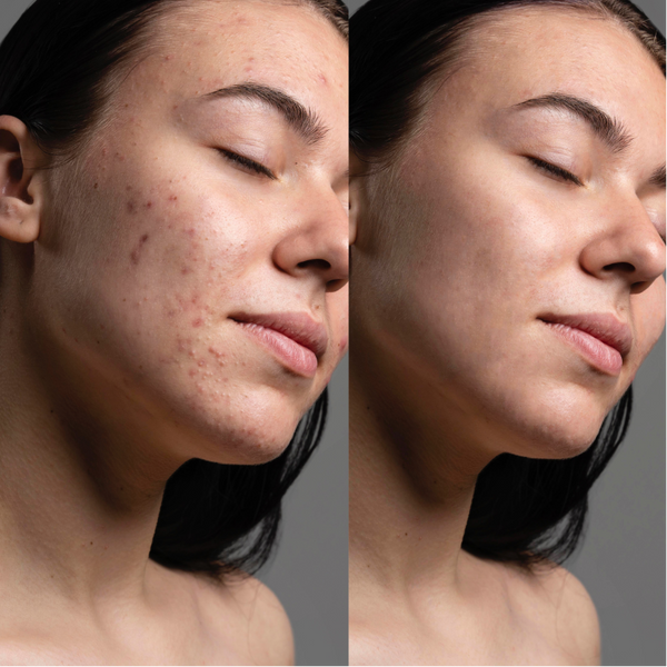 Вакуумний очищувач шкіри та пор Medica+ SKINCLEANER 9.0 WT MD-50118 фото