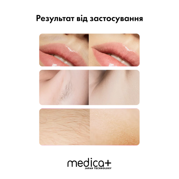 Фотоепілятор Medica+ Haircleaner 5.0 IPL MD-50126 фото