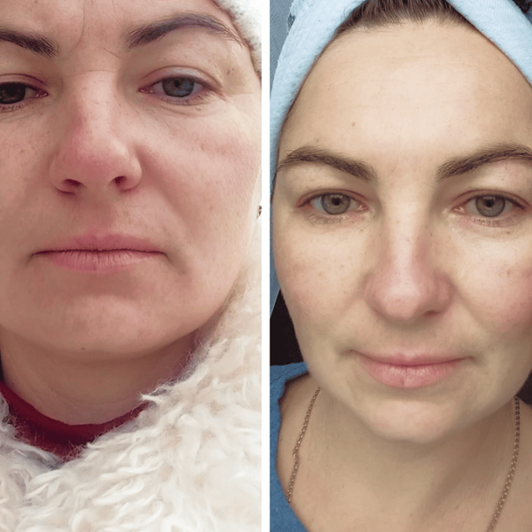 Заспокійлива маска для обличчя Medica+ Soothing Mask, 50 мл MD-60050 фото