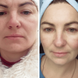 Заспокійлива маска для обличчя Medica+ Soothing Mask, 50 мл MD-60050 фото 10