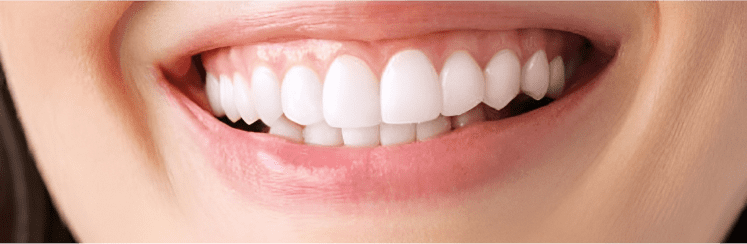 Відбілювальна піна для зубів Medica+ ToothMousse 5.0